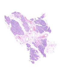 Human FFPE NAT Salivary Gland Tissue HuN-17-0002A