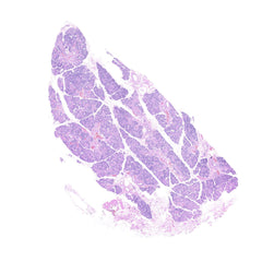 Human FFPE NAT Salivary Gland Tissue HuN-17-0002B
