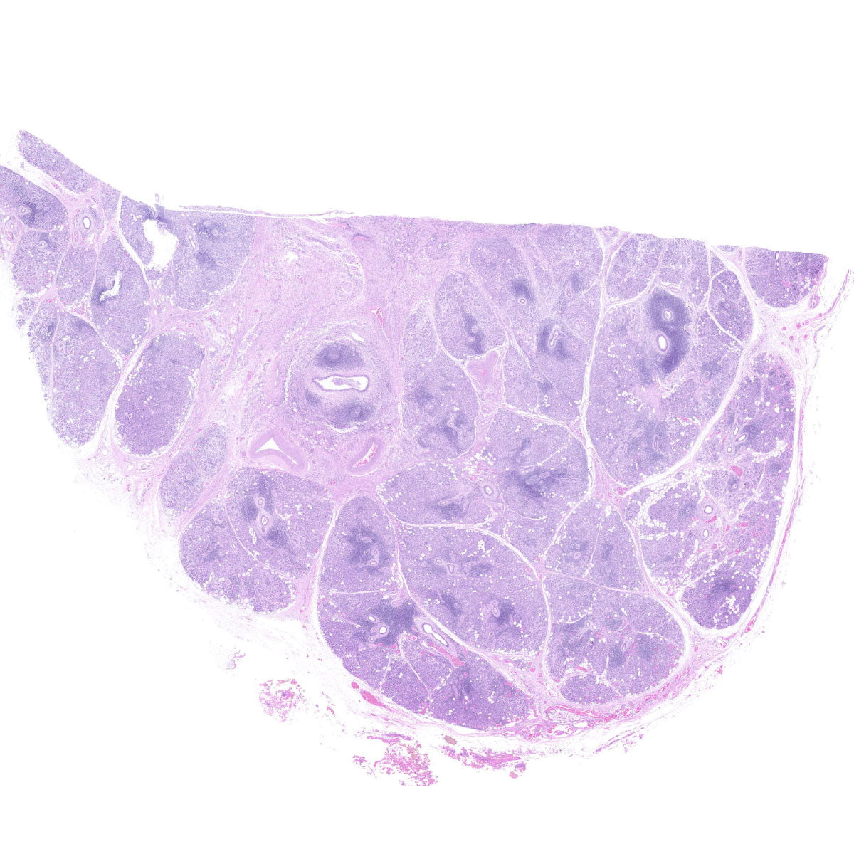 Human FFPE NAT Salivary Gland Tissue HuN-17-0003A