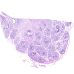 Human FFPE NAT Salivary Gland Tissue HuN-17-0003A