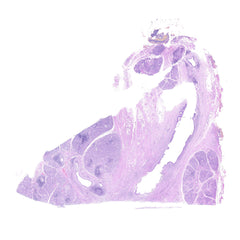 Human FFPE NAT Salivary Gland Tissue HuN-17-0003B