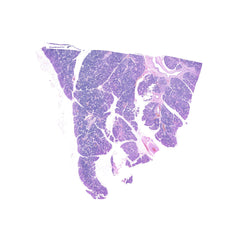 Human FFPE NAT Salivary Gland Tissue HuN-17-0004A