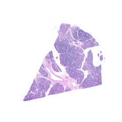 Human FFPE NAT Salivary Gland Tissue HuN-17-0004B