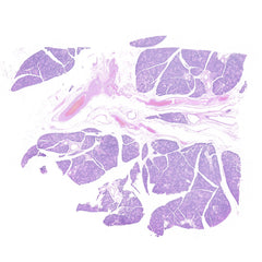 Human FFPE NAT Salivary Gland Tissue HuN-17-0005A