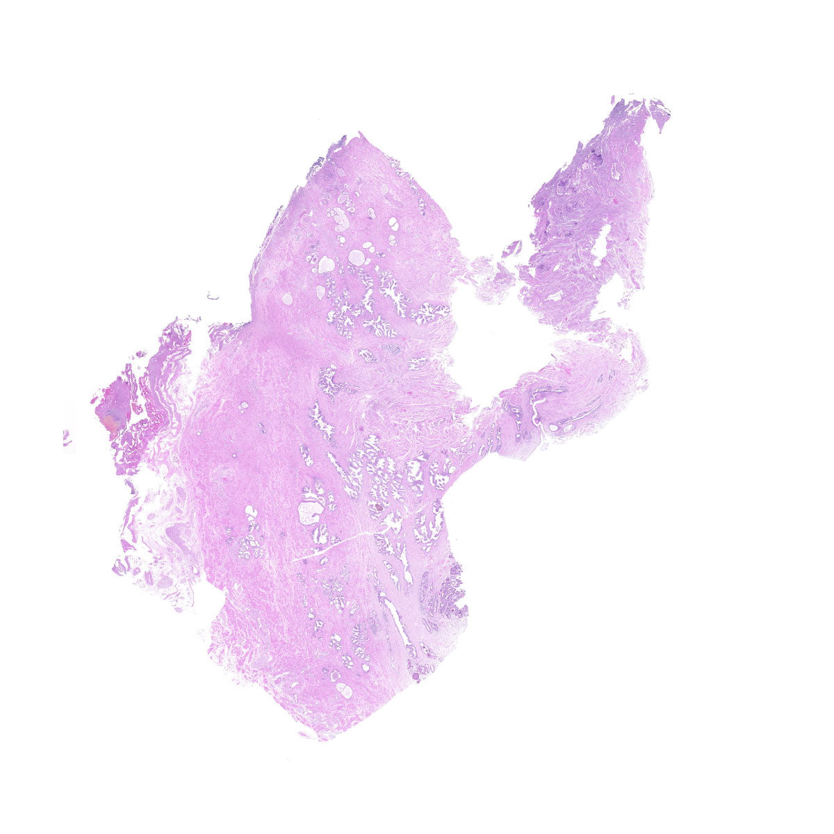 Human FFPE NAT Prostate Tissue HuN-21-0015