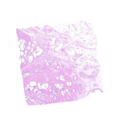 Human FFPE NAT Prostate Tissue HuN-21-0016D