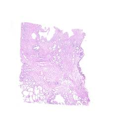 Human FFPE NAT Prostate Tissue HuN-21-0017B