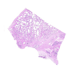 Human FFPE NAT Prostate Tissue HuN-21-0018A