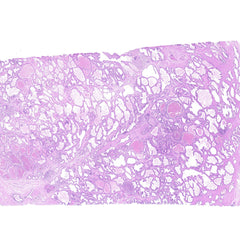 Human FFPE NAT Prostate Tissue HuN-21-0019A