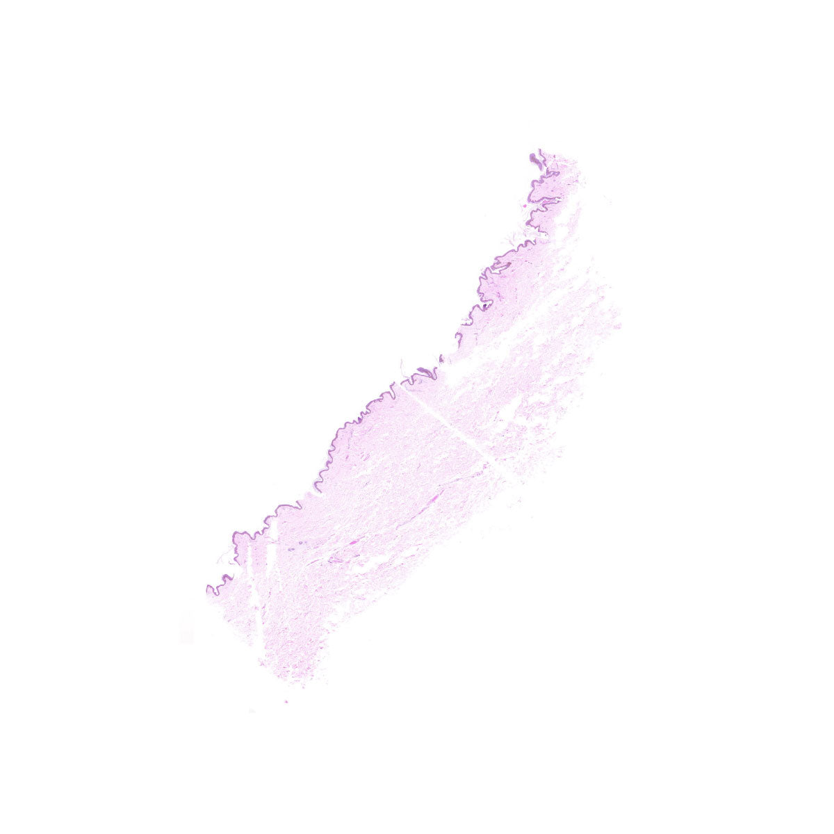Human FFPE NAT Skin Tissue HuN-22-0059A