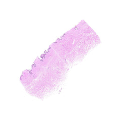 Human FFPE NAT Skin Tissue HuN-22-0059B