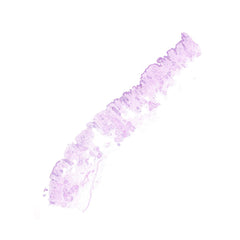 Human FFPE NAT Skin Tissue HuN-22-0062A