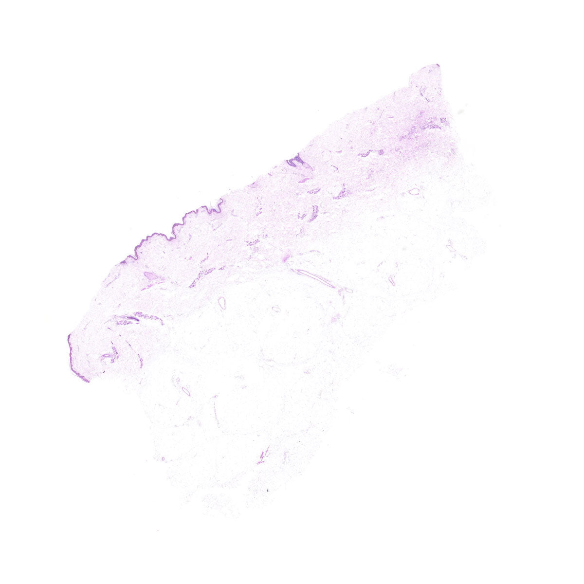Human FFPE NAT Skin Tissue HuN-22-0063A