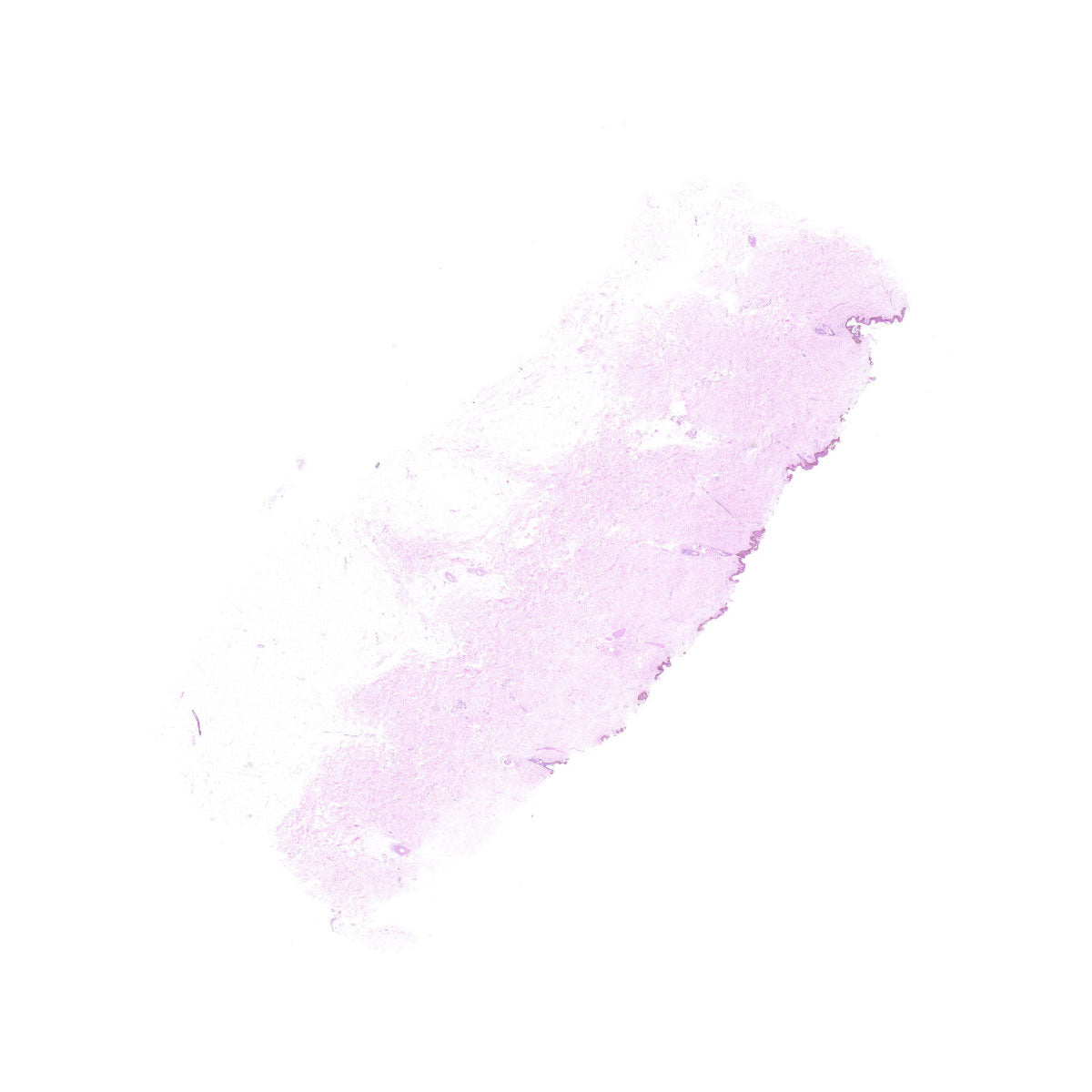 Human FFPE NAT Skin Tissue HuN-22-0066A