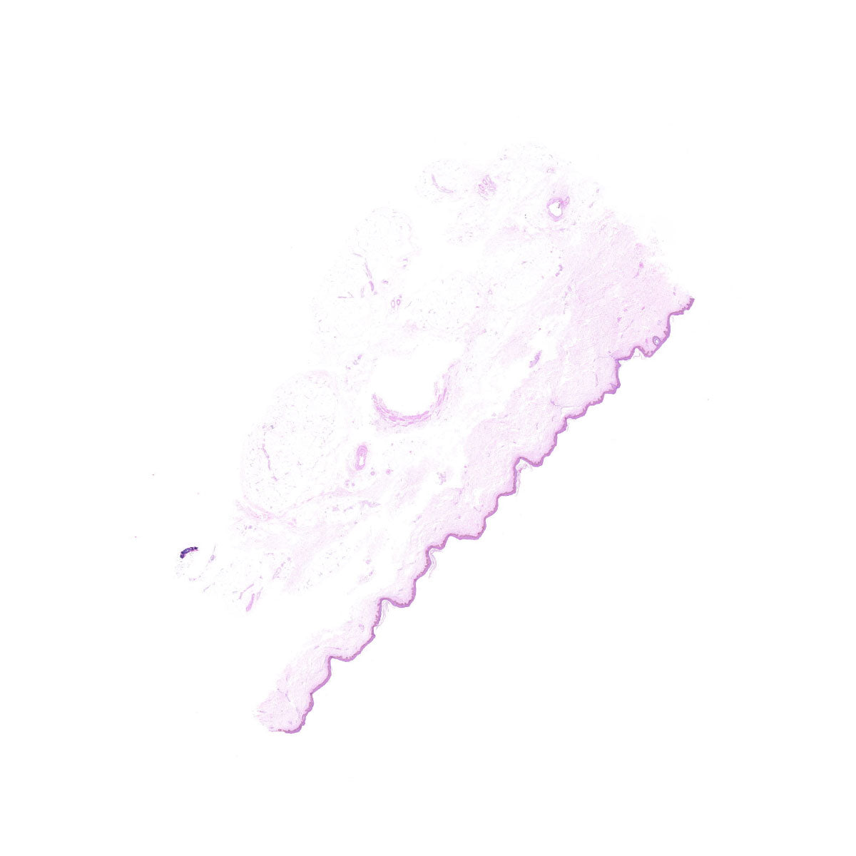 Human FFPE NAT Skin Tissue HuN-22-0067A