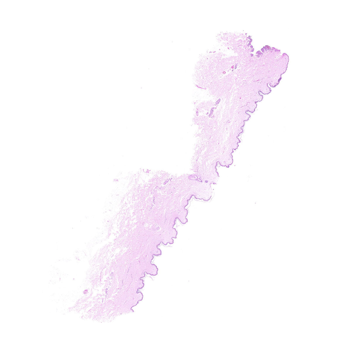 Human FFPE NAT Skin Tissue HuN-22-0070A