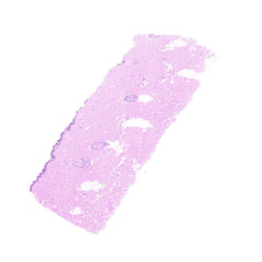 Human FFPE NAT Skin Tissue HuN-22-0071B