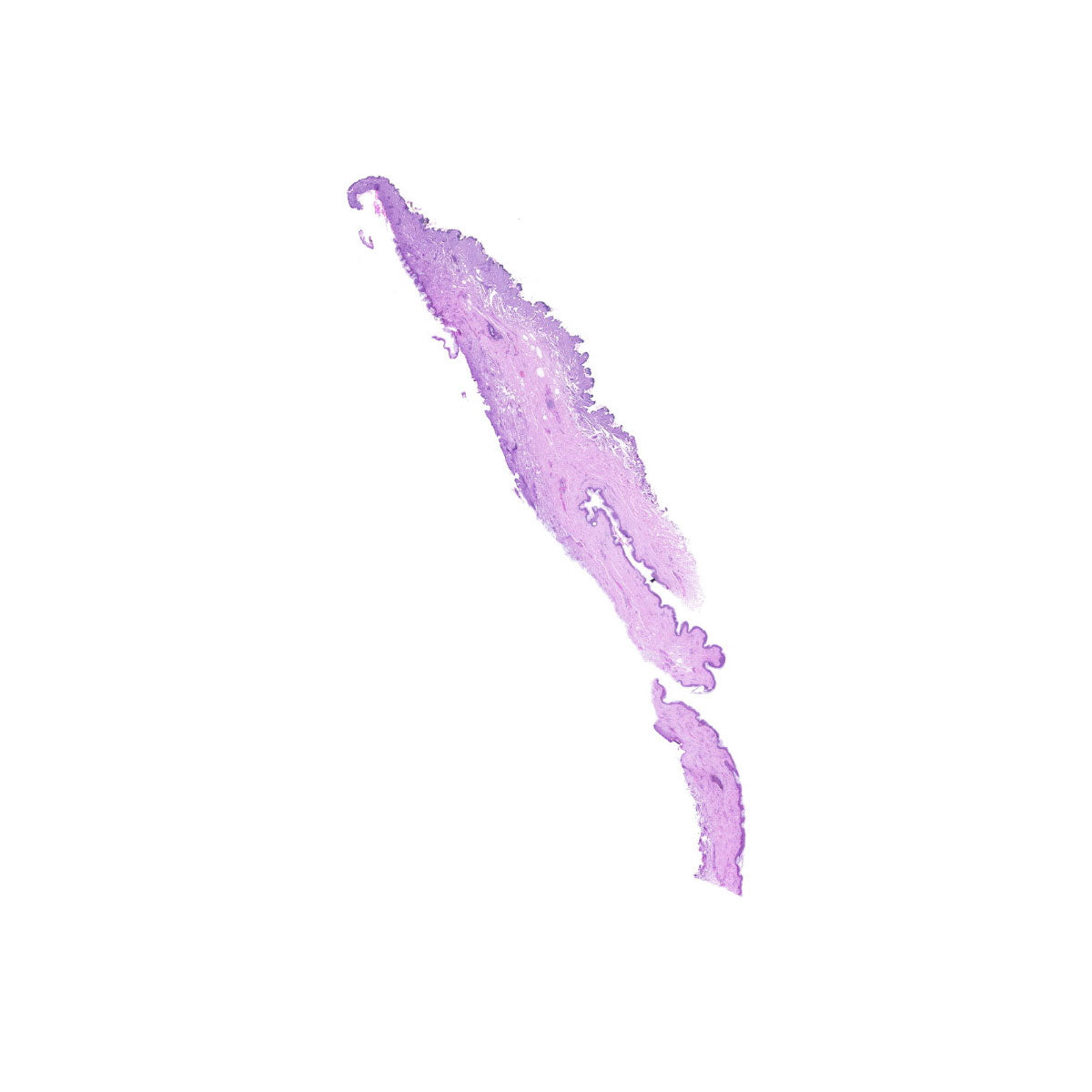 Human FFPE NAT Skin Tissue HuN-22-0073