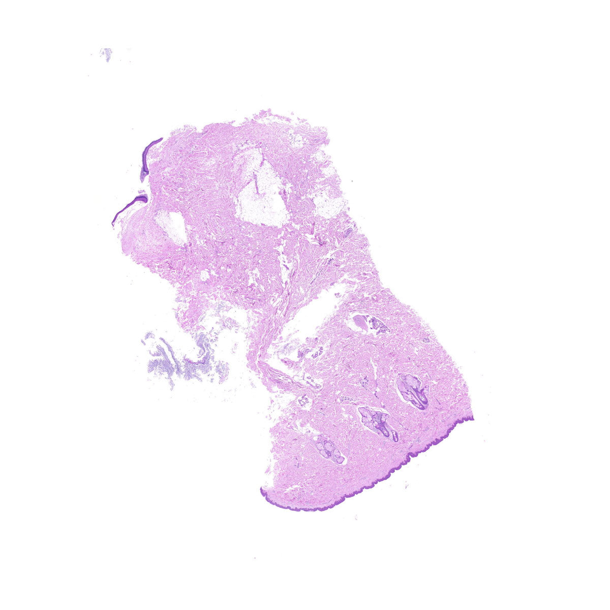 Human FFPE NAT Skin Tissue HuN-22-0076A