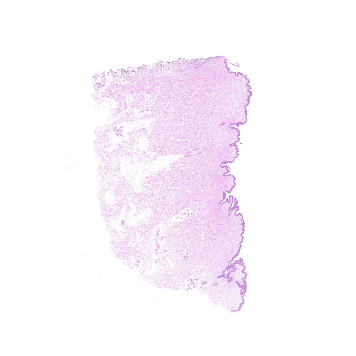 Human FFPE NAT Skin Tissue HuN-22-0079