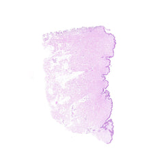 Human FFPE NAT Skin Tissue HuN-22-0079