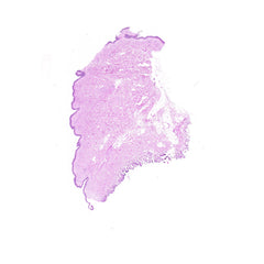 Human FFPE NAT Skin Tissue HuN-22-0080