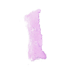 Human FFPE NAT Skin Tissue HuN-22-0081