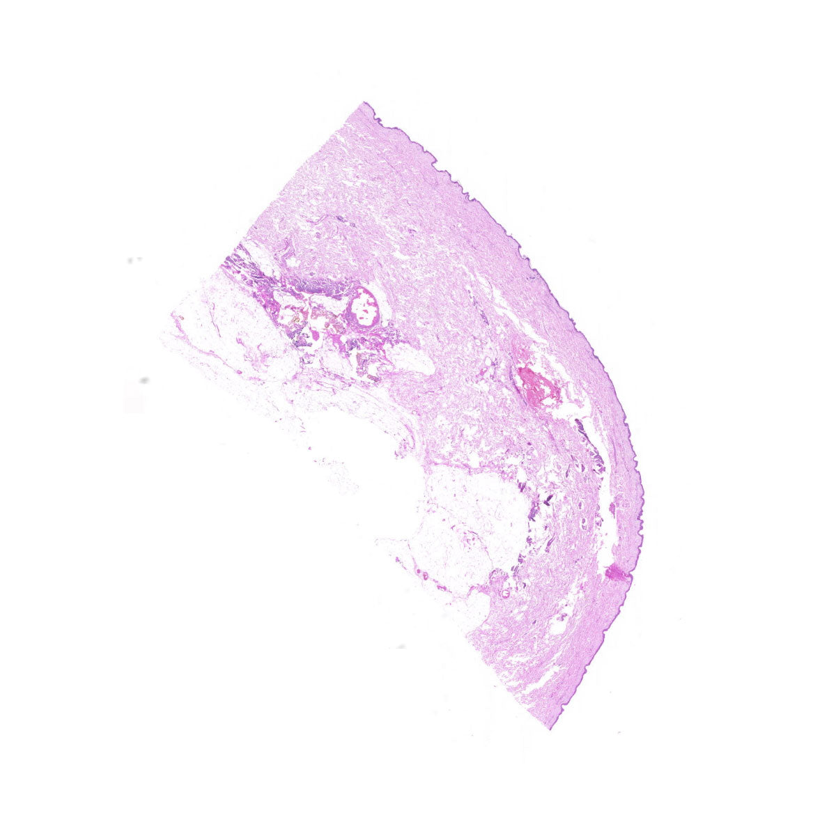 Human FFPE NAT Skin Tissue HuN-22-0087A