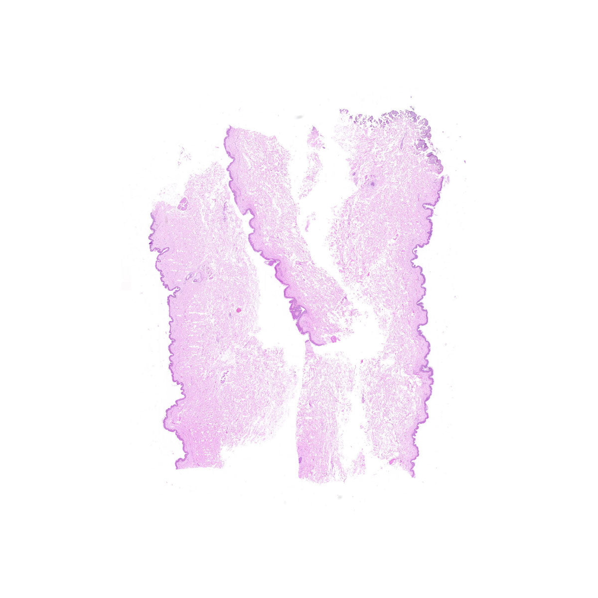 Human FFPE NAT Skin Tissue HuN-22-0088