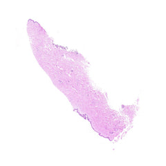 Human FFPE NAT Skin Tissue HuN-22-0098B