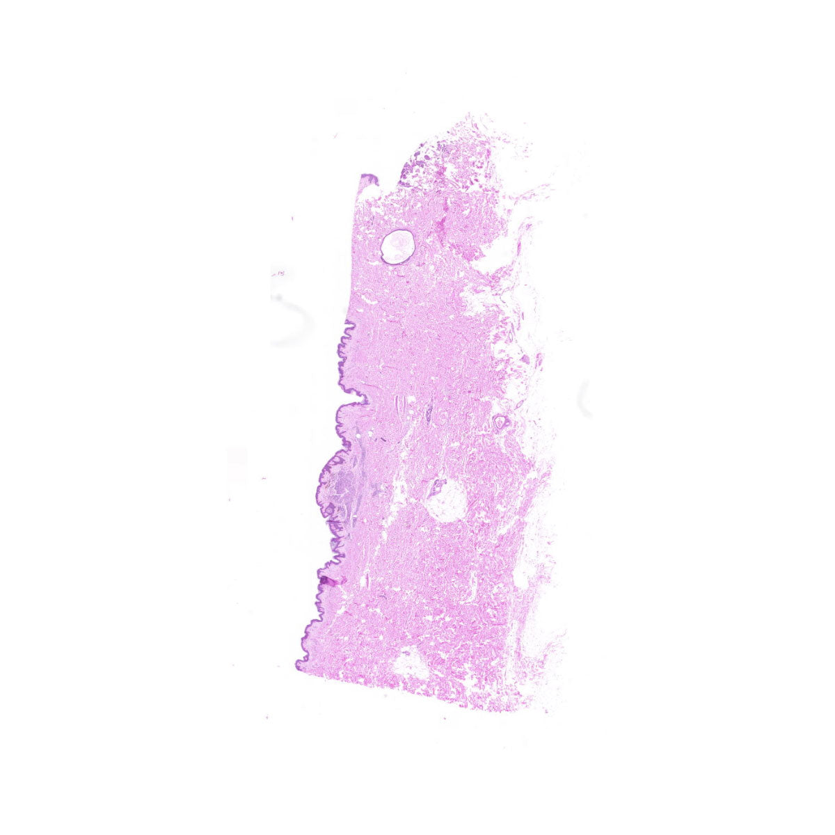 Human FFPE NAT Skin Tissue HuN-22-0099B