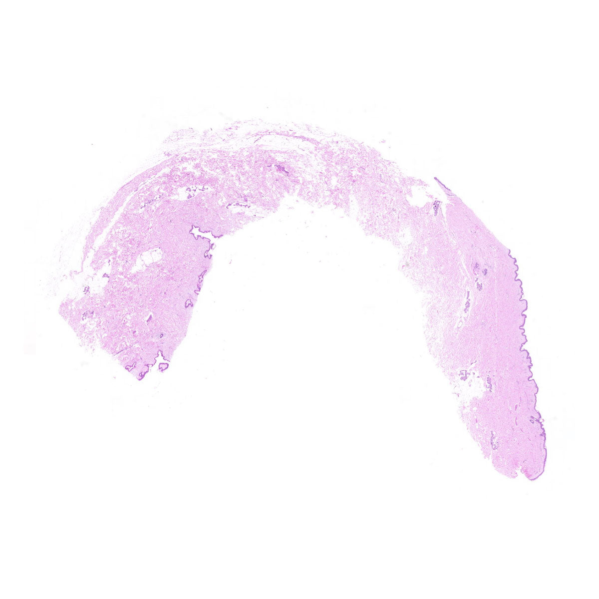 Human FFPE NAT Skin Tissue HuN-22-0100A