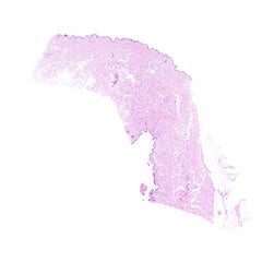 Human FFPE NAT Skin Tissue HuN-22-0100B