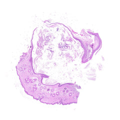 Human FFPE NAT Skin Tissue HuN-22-0107B