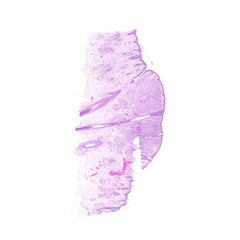 Human FFPE NAT Skin Tissue HuN-22-0110