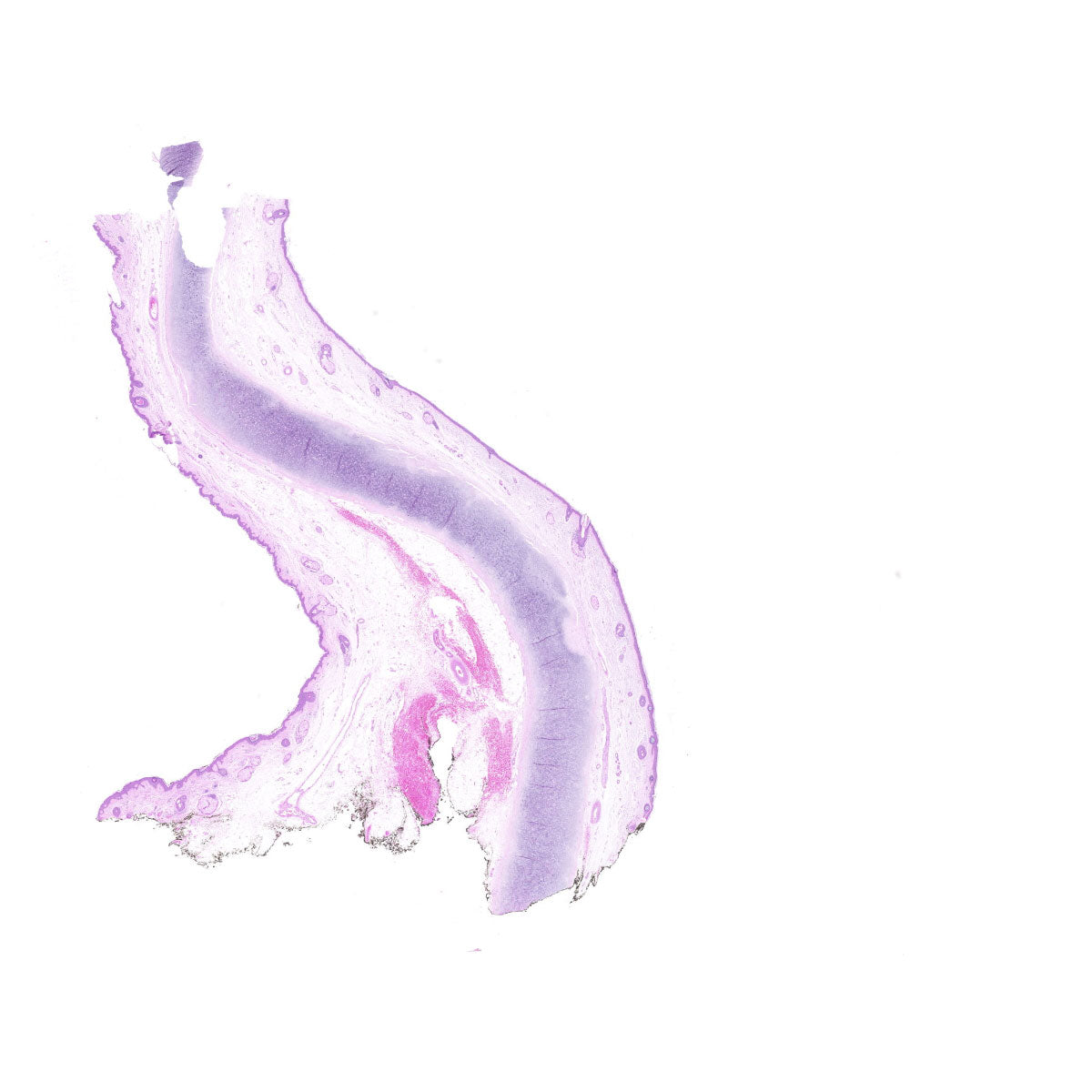 Human FFPE NAT Skin Tissue HuN-22-0112