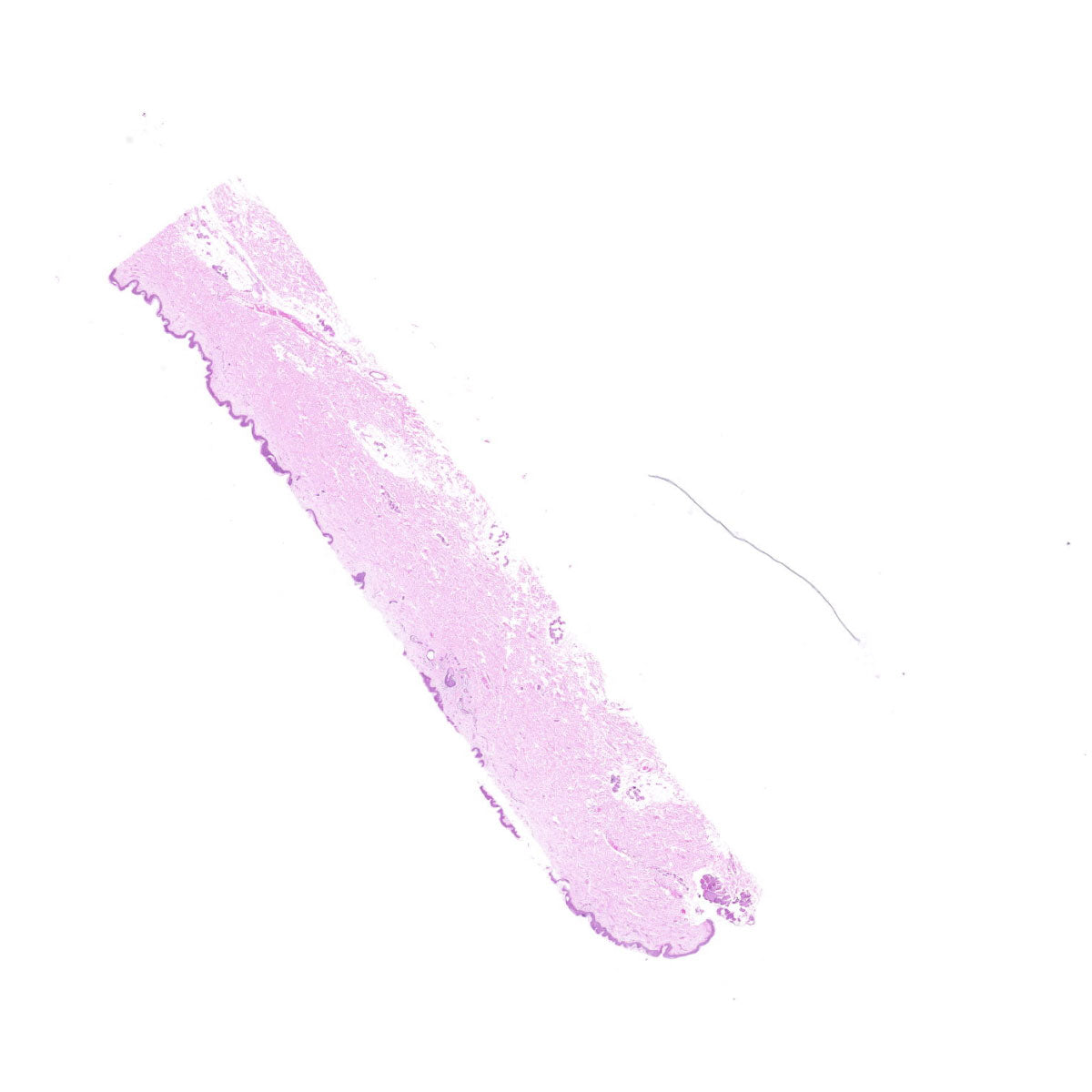 Human FFPE NAT Skin Tissue HuN-22-0125A