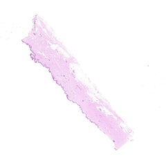 Human FFPE NAT Skin Tissue HuN-22-0125B