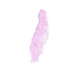 Human FFPE NAT Skin Tissue HuN-22-0126