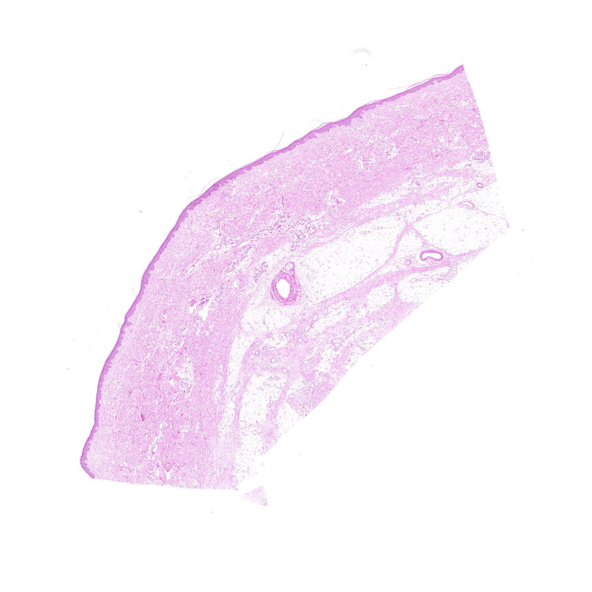 Human FFPE NAT Skin Tissue HuN-22-0128A