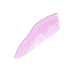 Human FFPE NAT Skin Tissue HuN-22-0128B