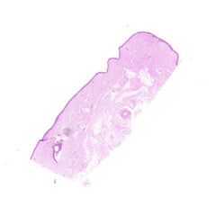 Human FFPE NAT Skin Tissue HuN-22-0133A