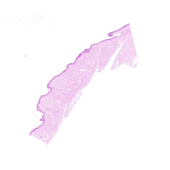 Human FFPE NAT Skin Tissue HuN-22-0133B