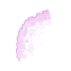 Human FFPE NAT Skin Tissue HuN-22-0134B