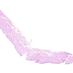 Human FFPE NAT Skin Tissue HuN-22-0138