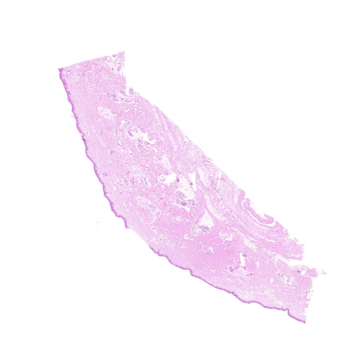 Human FFPE NAT Skin Tissue HuN-22-0139A