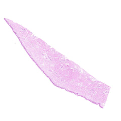 Human FFPE NAT Skin Tissue HuN-22-0139B