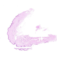 Human FFPE NAT Skin Tissue HuN-22-0140