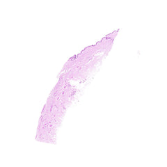 Human FFPE NAT Skin Tissue HuN-22-0143A