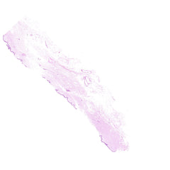 Human FFPE NAT Skin Tissue HuN-22-0144A